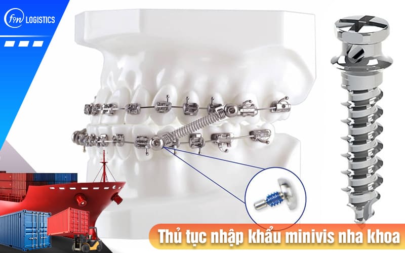 Thủ tục nhập khẩu minivis nha khoa cần phải lưu ý những quy định pháp luật nào? 7 Thu-tuc-nhap-khau-minivis-nha-khoa